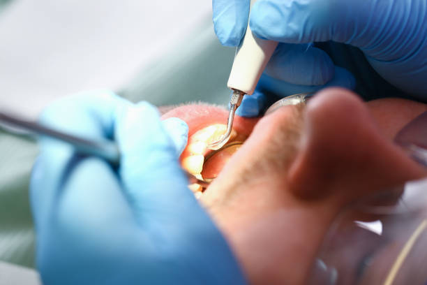 Best Emergency Treatment for Dental Infections or Abscesses in Pauls Valley, OK