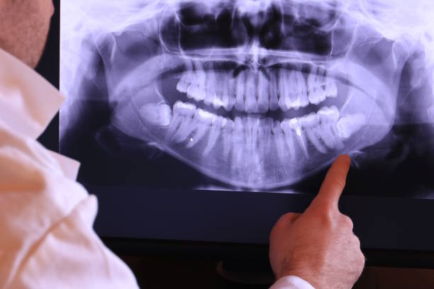 Best Emergency Dental Care for Broken or Chipped Teeth in Pauls Valley, OK