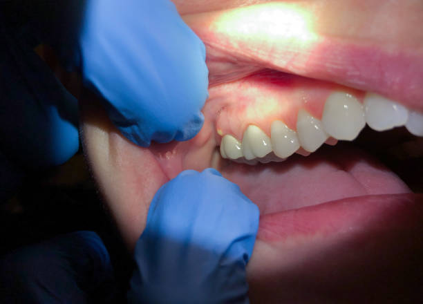 Best Cosmetic Emergency Dentistry in Pauls Valley, OK